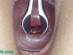 Cervix stretching wide with speculum and sperm in uterus tubes at lingerie-mania.com